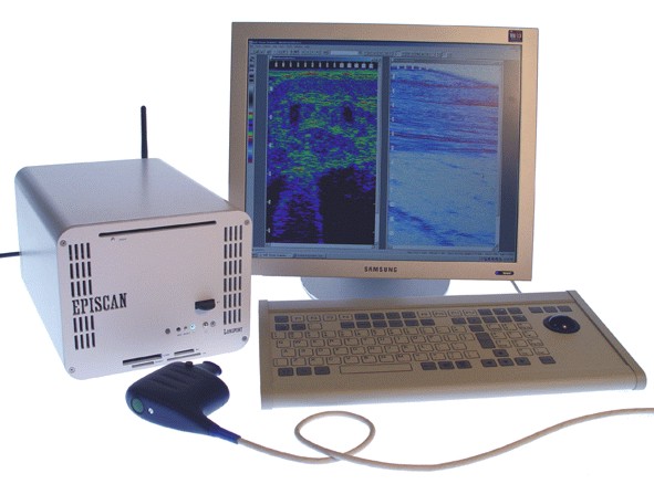 medical ultrasound technology